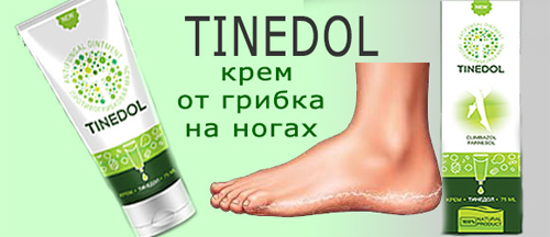 Тинедол от грибка на ногах Тинедол от грибка на ногах